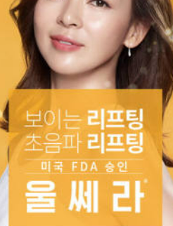 울쎄라의 모든 것 (원리, 장단점, 안즈의 특별함-샷수) 사진 5