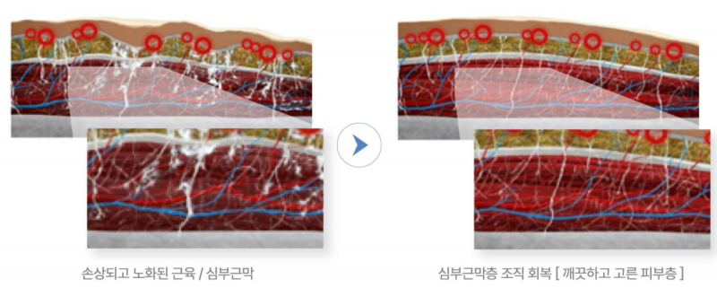 레비나스의 모든 것 (feat. 빠샤리프팅) 사진 14