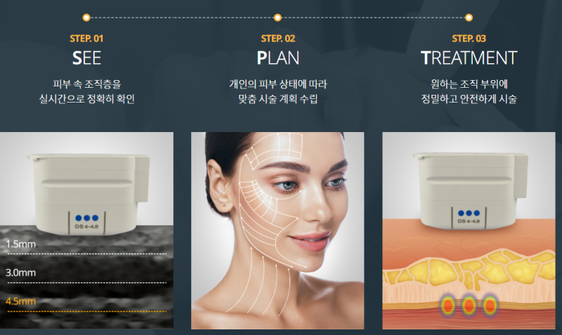 울쎄라 풀페이스 ANZ